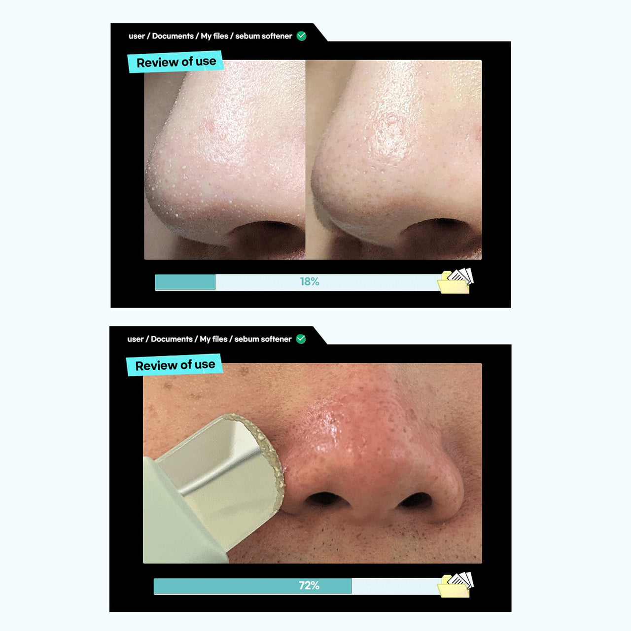 ILSO Super Melting SEBUM Softener + Deep Clean Master + 1/3 Saving Cotton Pad