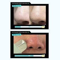 Thumbnail for ILSO Super Melting SEBUM Softener + Deep Clean Master + 1/3 Saving Cotton Pad