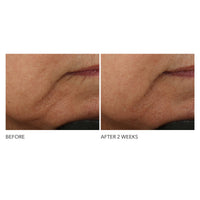 Thumbnail for Dr Dennis Gross Advanced Retinol + Ferulic Intense Wrinkle Cream | Intensely Hydrating to Visibly Transform Skin and Repair the Moisture Barrier | 2 oz