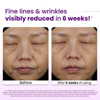 Thumbnail for Clean Skin Club Healthy Aging Clean Towels® XL, Smooths Fine Lines Wrinkles & Texture in 6 weeks, Treated for Extra Softness, Disposable Face Towels, Anti Aging Makeup Remover Dry Wipe, 50 count