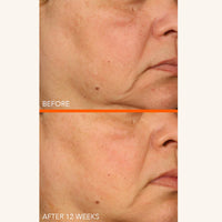 Thumbnail for Dr Dennis Gross Vitamin C Lactic 15% Firm & Brighten Serum: Visibly Improve Signs of Aging, 1 oz