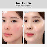 Thumbnail for TOSOWOONG Hyaluronic Acid Ampoule, Hydrating Glow and Skin Barrier Protection, Anti-Aging Face Serum for Dry Skin, Korean Skincare Beauty Products, 100ml, 3.38 fl. oz.