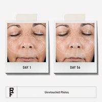 Thumbnail for Rodan + Fields Active Hydration Serum | 1oz | Boosts Hydration Levels | Glycerin | Hylauronic Acid