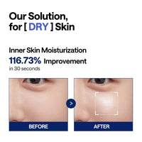 Thumbnail for MEDIHEAL Watermide Moisture Pad - Square Cotton Facial Toner Pads with Icelandic Glacial Water - Improve Skin Temperature, Hydrating to Dry, Puffy, Coarse Skin -Vegan Eco Silk Pads,100