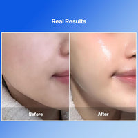 Thumbnail for Bluelayer Water Dome Mask - Korean Overnight Collagen Face Mask for Glass Skin, Moisturizing and Firming with Hyaluronic Acid & Blue Agave - Pore Minimizing with Hydrogel Masks for Radiant Glow - 4EA