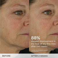 Thumbnail for TATCHA The Dewy Skin Cream | Rich Face Cream to Hydrate, Plump and Protect Dry and Combo Skin | 10 ml / 0.34 oz
