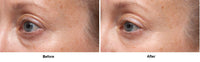 Thumbnail for Dr Dennis Gross Ferulic + Retinol Triple Correction Eye Serum: for Wrinkles, Loss of Elasticity, and Rough Texture, 0.5 fl oz