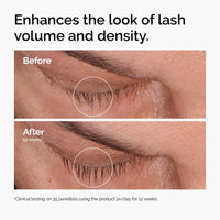 Thumbnail for The Ordinary Multi-Peptide Lash and Brow Serum, Peptide-Powered Formula for Thicker, Fuller Looking Lashes & Brows, 0.16 Fl Oz