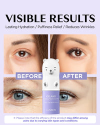 Thumbnail for THESAEM Iceland Hydrating Peptide Eye Stick 0.24oz - Elasticity, Cooling, Moisturizing Eye Balm for Loose Skin – Under Eye Treatment - Balm to Smooth Skin Texture - Daisy Flower Scent