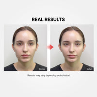 Thumbnail for Shumage Gold Seal Lifting Cream+Device - Moisturizer Face Lift Cream, Hydrating & Tightening for Sagging Skin - Korean Face Moisturizer - Microcurrent Facial Device for Radiant Glow Skin - 1.69 Fl. Oz