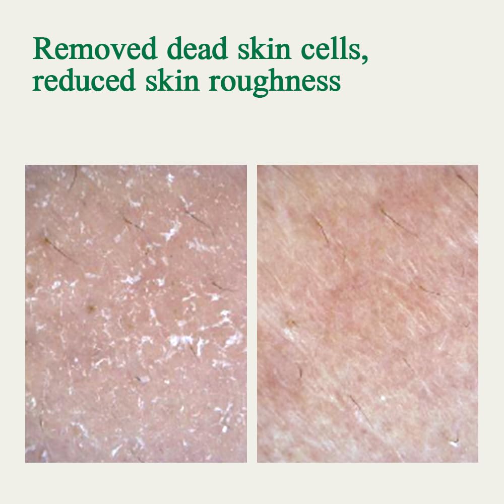 [PKY] Pyunkang Yul Ultimate Calming Solution Ampoule for Sensitive Skin with Patented Ingredients, Serum Intensely Calms & Soothes Redness with Cica & Tea Tree, Korean Skincare (1.01 Fl. Oz, 30ml)