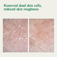 Thumbnail for [PKY] Pyunkang Yul Ultimate Calming Solution Ampoule for Sensitive Skin with Patented Ingredients, Serum Intensely Calms & Soothes Redness with Cica & Tea Tree, Korean Skincare (1.01 Fl. Oz, 30ml)