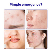 Thumbnail for Mediheal Derma Clear Madecassoside Blemish Spot Patch (44 Counts) - Acne Spot Protection, Spot Fast Healing with Madecassoside & Niacinamide