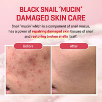 Thumbnail for SOME BY MI Snail Truecica Miracle Repair Cream - 2.02Oz, 60ml - Made from Snail Mucin for Sensitive Skin - Daily Repair Face Moisturizer for Acne Marks and Strengthen Skin Barrier - Korean Skin Care