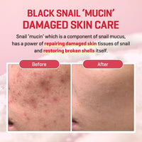 Thumbnail for SOME BY MI Snail Truecica Miracle Repair Low pH Gel Cleanser - 3.38Oz, 100ml - Made from Snail Mucin for Sensitive Skin - Daily Face Wash for Deep Cleansing and Skin Moisturizing - Korean Skin Care