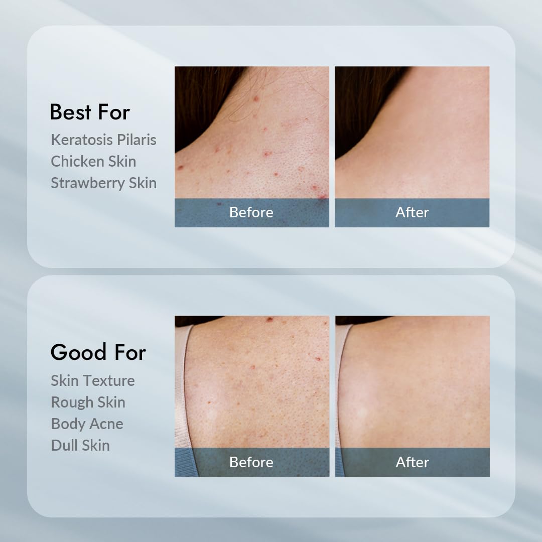 V11FACTORY AHA 12% Glycolic Acid Body Lotion – Korean Exfoliating & Hydrating Body Cream with Hyaluronic Acid & Collagen – Unscented, Paraben-Free Skin Smoothing Moisturizer, 10.6 oz