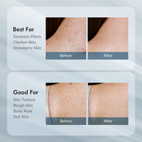 Thumbnail for V11FACTORY AHA 12% Glycolic Acid Body Lotion – Korean Exfoliating & Hydrating Body Cream with Hyaluronic Acid & Collagen – Unscented, Paraben-Free Skin Smoothing Moisturizer, 10.6 oz