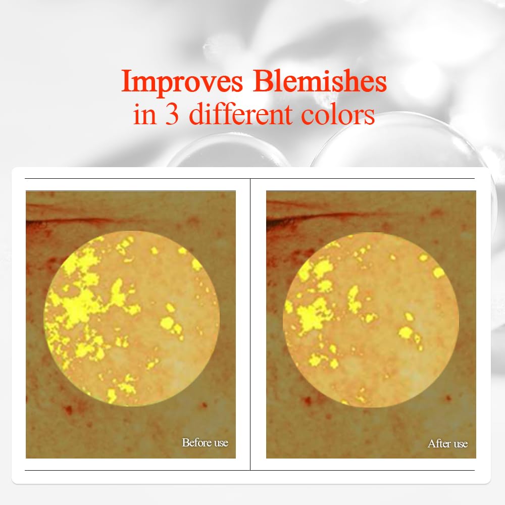 Pyunkang Yul Radiance Vita Serum, 1 Fluid Ounce – Hydrating Serum for Dry Skin with Hyaluronic Acid, Niacinamide, Panthenol, Pearl Extract, 24-Hour Moisturizing and Elasticity Care, EWG Green