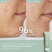 Thumbnail for Caudalie Vinopure Salicylic Acid Cleanser, Pore Purifying Gel Cleanser - 150 mL