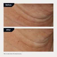 Thumbnail for Revision Skincare Nectifirm Advanced® Neck Cream – Clinically Proven to Firm, Lift & Contour the Neck, Jawline & Décolletage, Correcting Visible Signs of Aging and Weight Loss, 1.7 oz