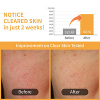 Thumbnail for numbuzin No.3 Toner Pads | Radiance Glowing Jumbo Essence Pad | Clear Glass Skin, Texture Care | Biodegradable Vegan Pads, Fermented Ingredients, Niacinamide | 70 pads/5.07 fl. oz.