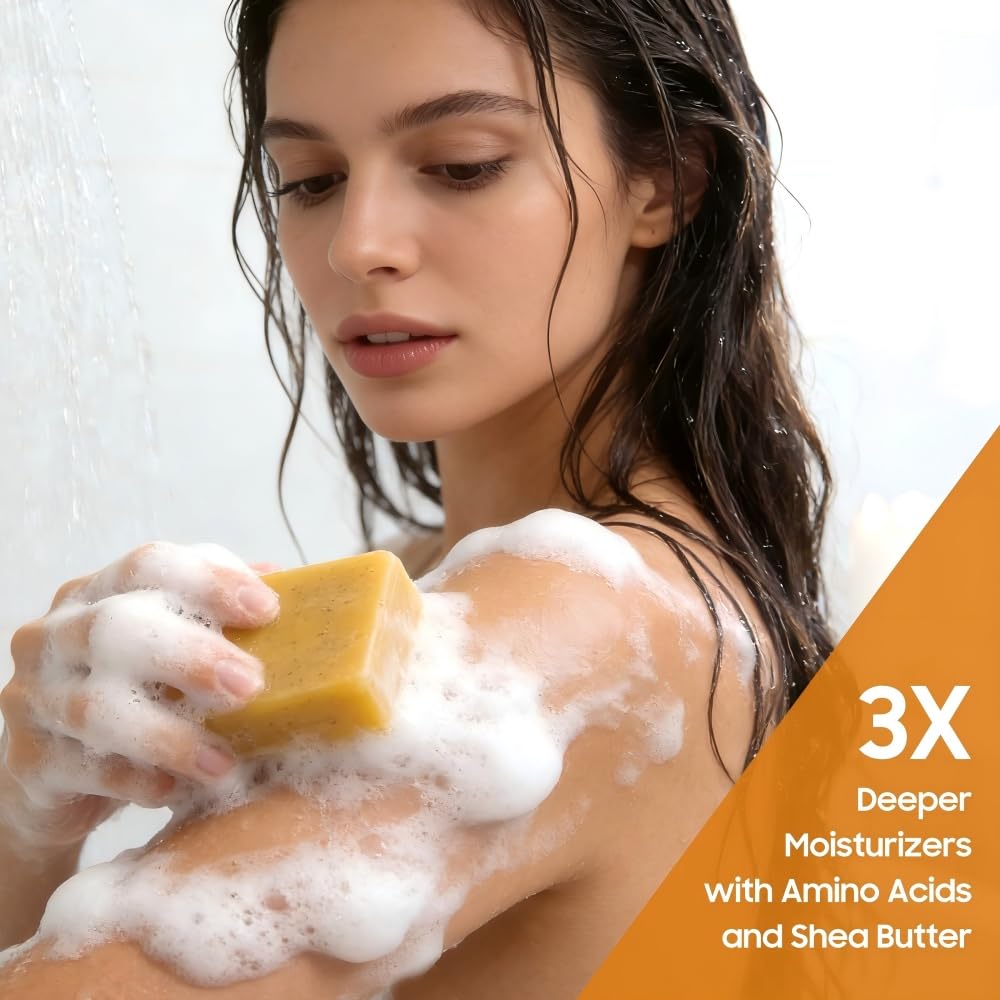 Uselective Lemon & Turmeric Soap Bar for Dark Spots, Powered by Kojic Acid & Vitamin C - Deeply Moisturizing with Amino Acids & Shea Butter - SLS Free for Face/Body