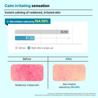 Thumbnail for Mediheal Derma Modeling Pack (Madecassoside) - Relieving Blemish Marks For Clear Skin - Easy DIY Home Spa Kits, Hydrating Icy Jelly Mask For Skin Refreshment