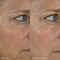 Thumbnail for Tatcha The Silk Serum Wrinkle-Smoothing Retinol Alternative | 30 ml / 1 oz