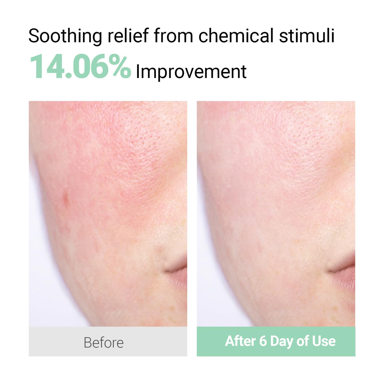NEAF NEAF Soothing Calm Cream with Panthenol, Hyaluronic Acid for Sensitive Skin, Lightweight, Korean Skincare (50ml/ 1.76 oz.) Nourishing Skin Barrier Moisturizer