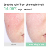 Thumbnail for NEAF NEAF Soothing Calm Cream with Panthenol, Hyaluronic Acid for Sensitive Skin, Lightweight, Korean Skincare (50ml/ 1.76 oz.) Nourishing Skin Barrier Moisturizer