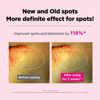 Thumbnail for ISOI Blemish Care Up Cream, Hydrating & Skin Barrier Care with Bulgarian Rose Oil & 5-Layer Hyaluronic Acid, Korean Skin Care Acne (1.86 fl.oz, 55ml)