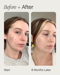 Thumbnail for Topicals Faded Brightening and Clearing Serum | Reduces Discoloration, Post-Blemish Marks, Scars and Spots | Contains Kojic Acid and Niacinamide | Dermatologist-tested, Vegan, Cruelty-Free (0.5 Fl Oz)