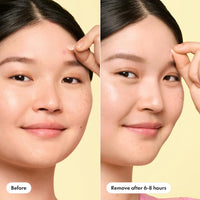 Thumbnail for Mighty Patch Mini Invisible+ Patches - X-Small Daytime Hydrocolloid Acne Pimple Patches for Covering Zits & Blemishes, Blends Into Skin & Barely There (30 Count, 10mm Patch)