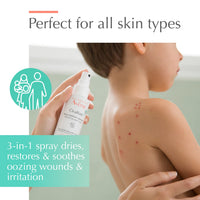 Thumbnail for Avène Cicalfate+ Absorbing Soothing Spray to dry and restore irritated, sensitive skin, helps restore skin barrier, safe for infants, children and adults