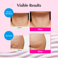 Thumbnail for EQQUALBERRY NAD+ Peptide Boosting Cream – NAD+ 5% & 13 Peptides Anti-Aging Korean Skincare Face & Body Cream | Firming & Lifting Pink Neck Cream for Sagging Skin (1.69 fl.oz / 50ml)