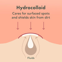 Thumbnail for Rael Pimple Patches, Miracle Invisible Spot Cover - Hydrocolloid Acne Patch, Treatment for Breakouts, Absorbs Zits & Blemish, Korean Skin Care, 2 Sizes (96 Count)