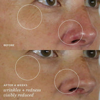 Thumbnail for Tatcha The Silk Serum Wrinkle-Smoothing Retinol Alternative | 30 ml / 1 oz