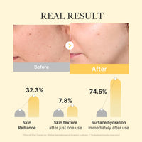 Thumbnail for medicube Jelly Gel Mask with Brightening Kojic Acid Turmeric | Overnight Face Mask for Glass Glow Skin | Elasticity, Hydrating, Firming and Radiance Boosting | Korean Skincare, 28g x 4ea