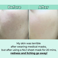 Thumbnail for numbuzin No.1 Sheet Mask | Dewy Glow Spa Sheet Mask | Hydrating with 81% Jeju Cypress Water, Heartleaf Extract | Soothes, Revitalizes Sensitive Irritated Skin | Korean Skincare | 4 Sheets