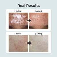 Thumbnail for numbuzin No.1 Toner | Pure-Full Calming Herb Toner | Breakouts, Redness, Excess Oil Control | Centella Asiatica, Heartleaf, Licorice Root | Acne-Prone, Sensitive Skin | 10.14 fl. oz.