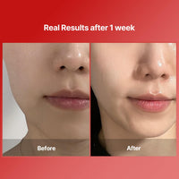 Thumbnail for Shumage Gold Seal Wrapping Mask - Collagen Peel Off Face Mask for Glass Skin - Overnight Mask with Gold Threads for Hydrating and Tightening - Long-lasting Elasticity and Radiant Glow - 3.17 oz.