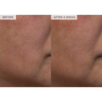 Thumbnail for Glow Recipe PHA + BHA Face Toner - Korean Skin Care Pore Minimizer & Gentle Facial Exfoliator for Tightening, Hydrating & Exfoliating - Glycerin, Watermelon & Cactus Water (150ml)