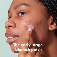 Thumbnail for Mighty Patch Micropoint™ for Blemishes from Hero Cosmetics - Hydrocolloid Acne Spot Treatment Patch for Early Stage Zits and Hidden Pimples, 395 Micropoints (8 Patches)