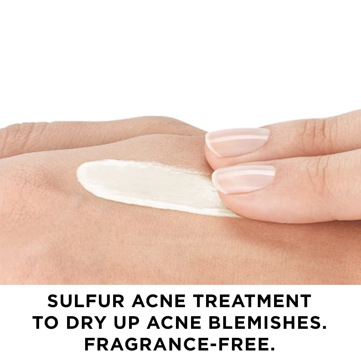 Vichy Normaderm S.O.S Acne Rescue Spot Corrector, 10% Sulfur + Glycolic Acid + Niacinamide, Blackhead Remover & Acne Spot Treatment For Face, Helps Clear & Prevent Acne, Paraben & Oil Free