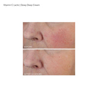 Thumbnail for Dr Dennis Gross Vitamin C Lactic Dewy Deep Cream: Ultra-Rich, Replenishing Cream for a Dewy Finish, 2 oz