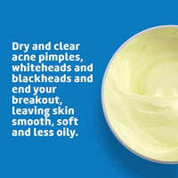 Thumbnail for De La Cruz 10% Sulfur Ointment Cystic Acne Spot Treatment for Face & Body Skin Care Face Mask & Blackhead Remover, Treatment for Hormonal Acne 2.6 oz, 2 Pack