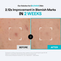 Thumbnail for MEDIHEAL Madecassoside Blemish Pad - Square Cotton Facial Toner Pads with Centella Asiatica & Madecassoside – Anti Blemish to Improve Uneven Skin Tone - Vegan Face Gauze Pads, 100