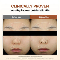 Thumbnail for [BY WISHTREND] Mandelic Acid 5% Skin prep Water, Gentle Skin Korean exfoliator for face, Aha Bha Toner, Ideal for Sensitive Skin (1 Fl Oz (Pack of 1))