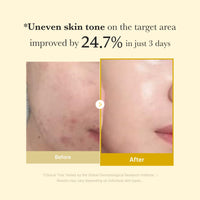 Thumbnail for medicube Kojic Acid Turmeric Overnight Wrapping Peel Off Mask – Brightens & Defends Against Skin Stress for a Clear, Glowing Complexion, Korean Skincare, 2.53 fl. oz.