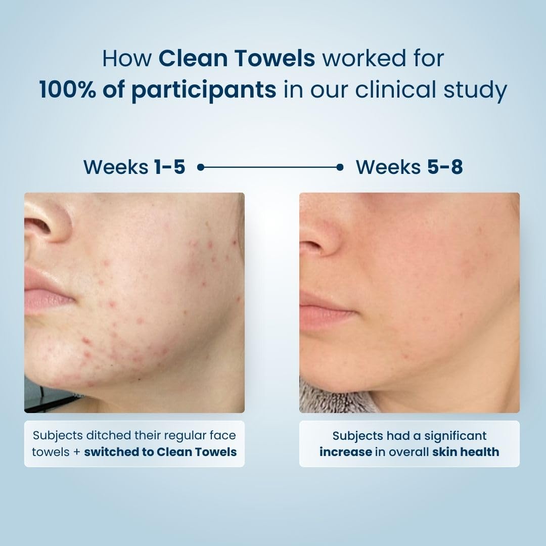 Clean Skin Club Clean Towels™, 100% USDA Biobased Dermatologist Approved Face Towel, Disposable Clinically Tested Face Towelette, Facial Washcloth, Makeup Remover Dry Wipes, Ultra Soft, 25 ct, 4 pack